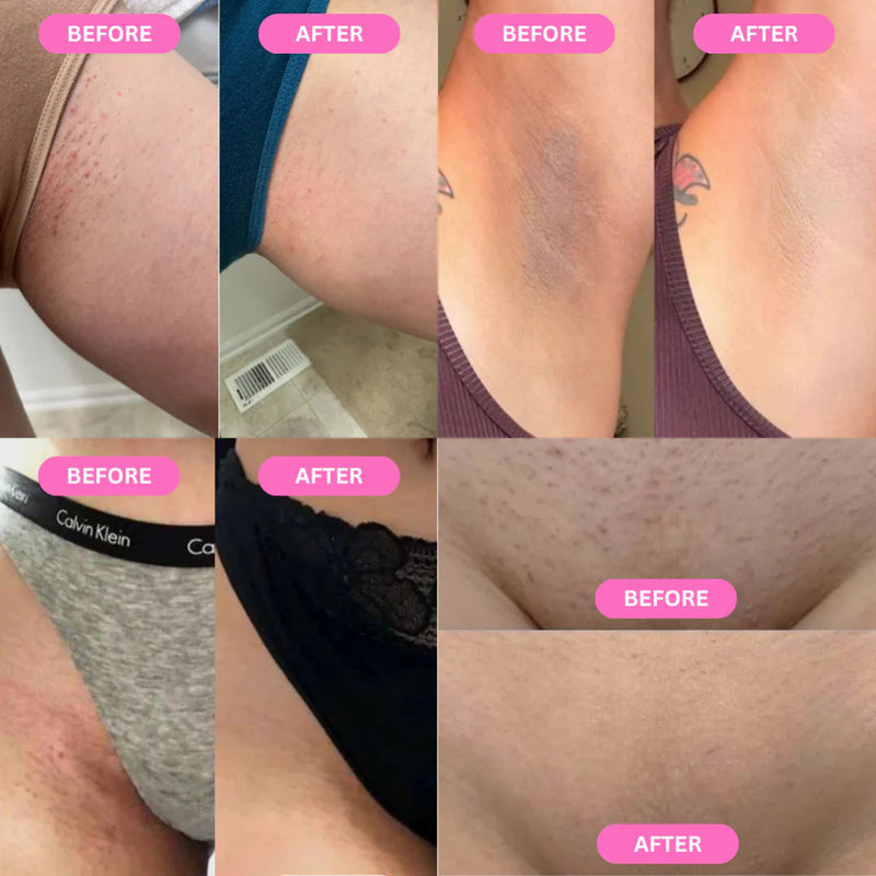 Before and after comparison of skin treatment on various body parts.